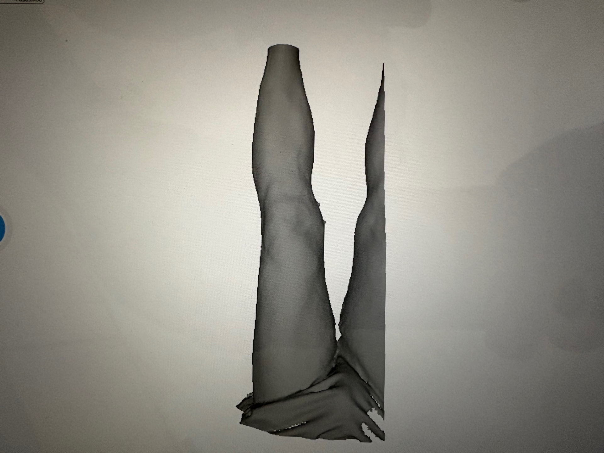 Real 3D scan of a patient's legs used to build a custom brace